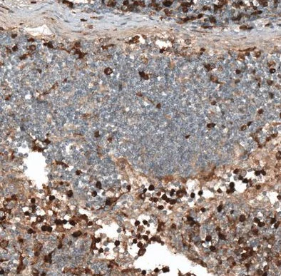 Immunohistochemistry (Formalin/PFA-fixed paraffin-embedded sections) - Anti-HJURP antibody (AB224076)