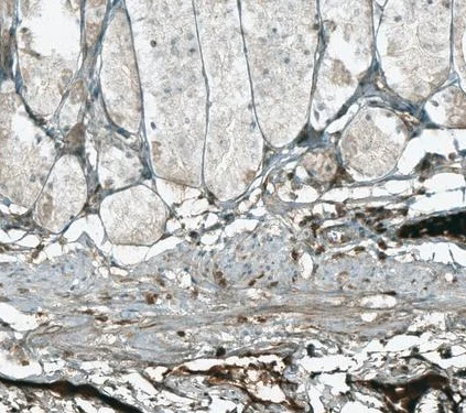 Immunohistochemistry (Formalin/PFA-fixed paraffin-embedded sections) - Anti-HJURP antibody (AB224076)