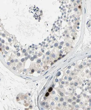 Immunohistochemistry (Formalin/PFA-fixed paraffin-embedded sections) - Anti-HJURP antibody (AB224076)