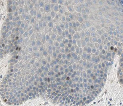 Immunohistochemistry (Formalin/PFA-fixed paraffin-embedded sections) - Anti-HJURP antibody (AB224076)