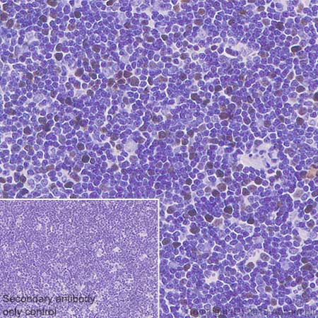 Immunohistochemistry (Formalin/PFA-fixed paraffin-embedded sections) - Anti-HJURP antibody [EPR22619-41] (AB233541), expandable thumbnail