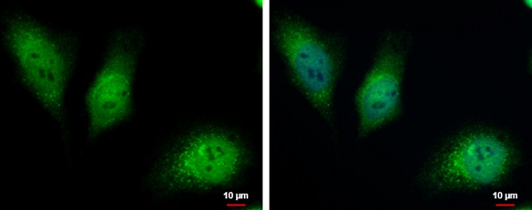 Immunocytochemistry/ Immunofluorescence - Anti-HKDC1 antibody (AB228729)