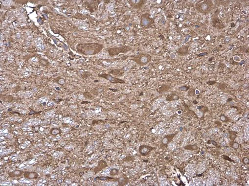 Immunohistochemistry (Formalin/PFA-fixed paraffin-embedded sections) - Anti-HKDC1 antibody (AB228729)