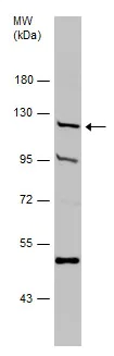Western blot - Anti-HKDC1 antibody (AB228729)