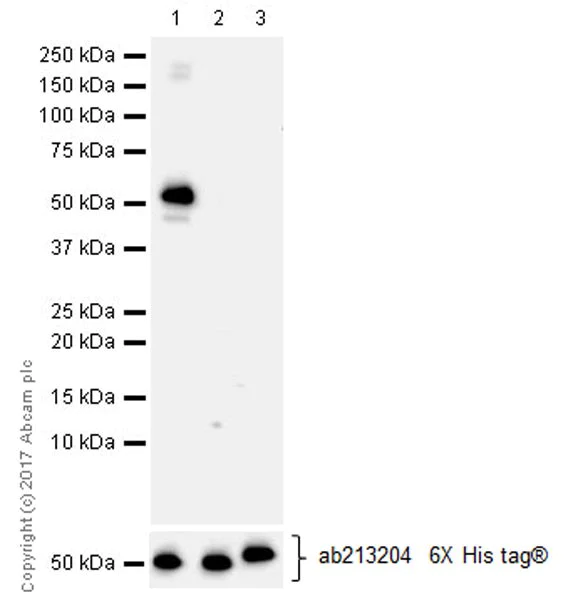 Western blot - Anti-HKDC1 antibody [EPR19835] (AB209846)