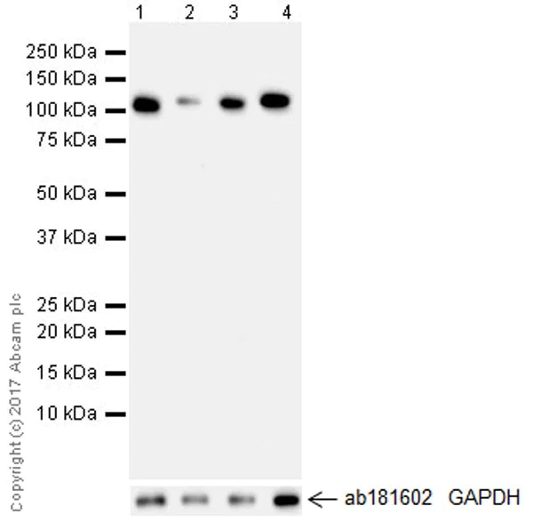 Western blot - Anti-HKDC1 antibody [EPR19835] (AB209846)