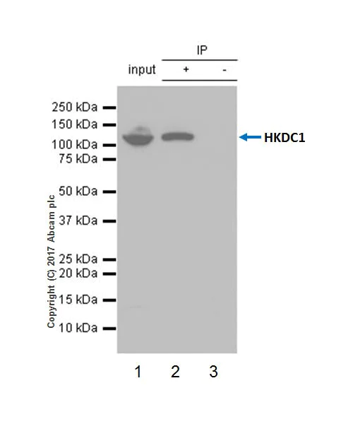 Immunoprecipitation - Anti-HKDC1 antibody [EPR19835] - BSA and Azide free (AB228817)