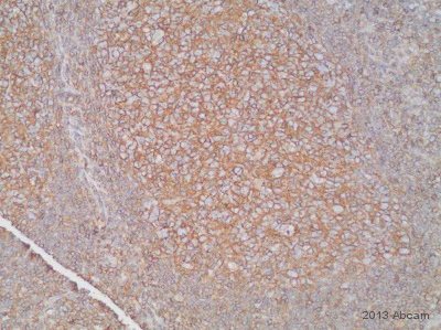 Immunohistochemistry (Formalin/PFA-fixed paraffin-embedded sections) - Anti-HLA A antibody [EP1395Y] (AB52922)