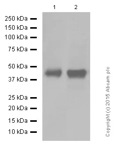 Western blot - Anti-HLA A antibody [EP1395Y] (AB52922)