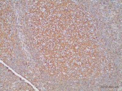 Immunohistochemistry (Formalin/PFA-fixed paraffin-embedded sections) - Anti-HLA A antibody [EP1395Y] - Low endotoxin, Azide free (ab246691), expandable thumbnail