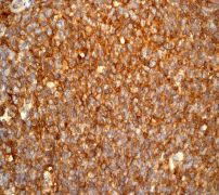 Immunohistochemistry (Formalin/PFA-fixed paraffin-embedded sections) - Anti-HLA A antibody [EP1395Y] - Low endotoxin, Azide free (ab246691), expandable thumbnail