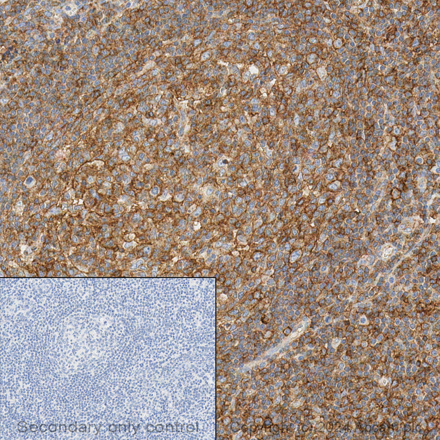 Immunohistochemistry (Formalin/PFA-fixed paraffin-embedded sections) - Anti-HLA A antibody [EP1395Y] - Low endotoxin, Azide free (ab246691), expandable thumbnail