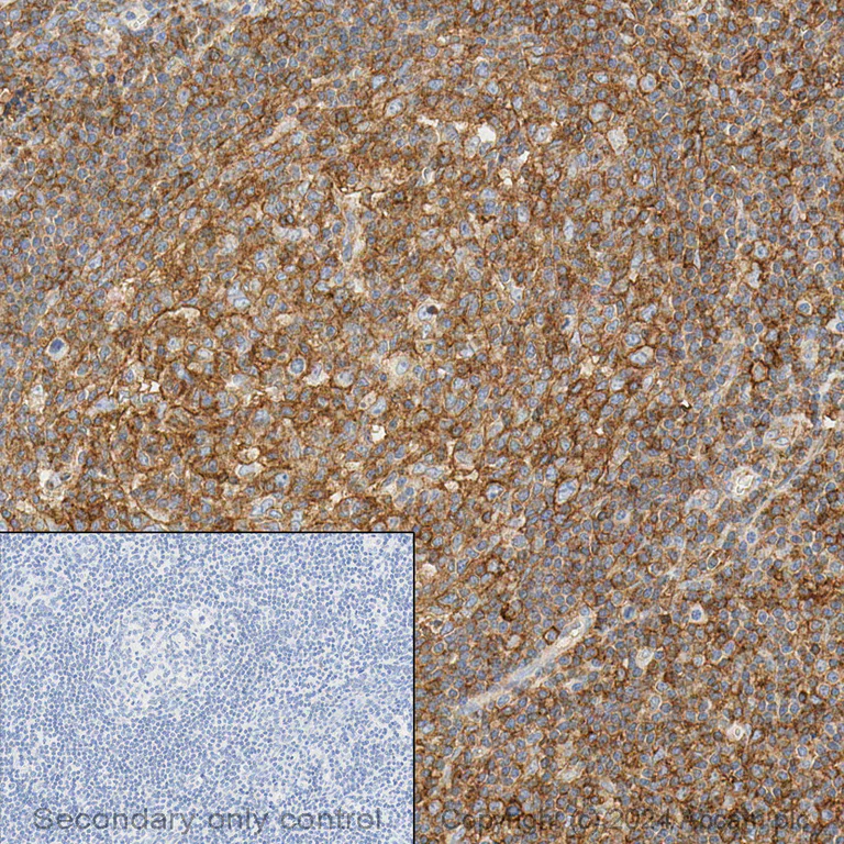 Immunohistochemistry (Formalin/PFA-fixed paraffin-embedded sections) - Anti-HLA A antibody [EP1395Y] - Low endotoxin, Azide free (AB246691)