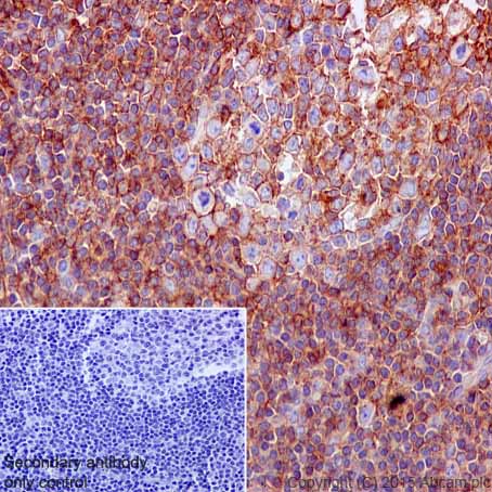 Immunohistochemistry (Formalin/PFA-fixed paraffin-embedded sections) - Anti-HLA A antibody [EP1395Y] - Low endotoxin, Azide free (ab246691), expandable thumbnail