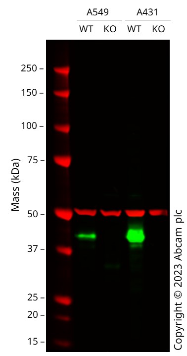 Western blot - Anti-HLA A antibody [EP1395Y] - Low endotoxin, Azide free (ab246691), expandable thumbnail