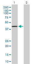 Western blot - Anti-HLA A2 antibody (AB168405), expandable thumbnail