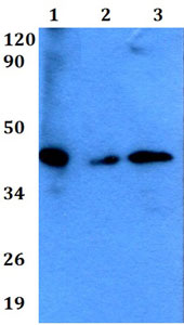 Western blot - Anti-HLA-A+HLA-B+HLA-C antibody (AB200740)