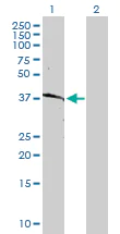 Western blot - Anti-HLA B antibody (AB168436)