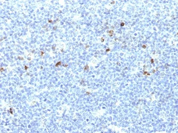 Immunohistochemistry (Formalin/PFA-fixed paraffin-embedded sections) - Anti-HLA B7 antibody [CATA-1] (AB236491)