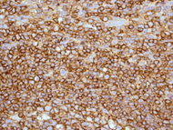 Immunohistochemistry (Formalin/PFA-fixed paraffin-embedded sections) - Anti-HLA B7 antibody [EPR2623(2)] (AB109089), expandable thumbnail