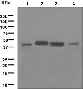Western blot - Anti-HLA B7 antibody [EPR2623(2)] (AB109089), expandable thumbnail