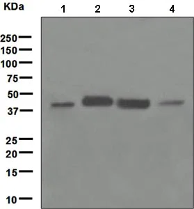 Western blot - Anti-HLA B7 antibody [EPR2623(2)] (AB109089)