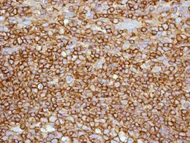 Immunohistochemistry (Formalin/PFA-fixed paraffin-embedded sections) - Anti-HLA B7 antibody [EPR2623(2)] - BSA and Azide free (AB247757)
