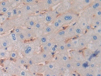 Immunohistochemistry (Formalin/PFA-fixed paraffin-embedded sections) - Anti-HLA-C antibody (AB232903)