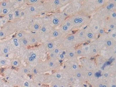 Immunohistochemistry (Formalin/PFA-fixed paraffin-embedded sections) - Anti-HLA-C antibody (AB232903)