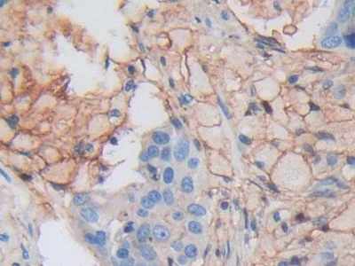 Immunohistochemistry (Formalin/PFA-fixed paraffin-embedded sections) - Anti-HLA-C antibody (AB232903)