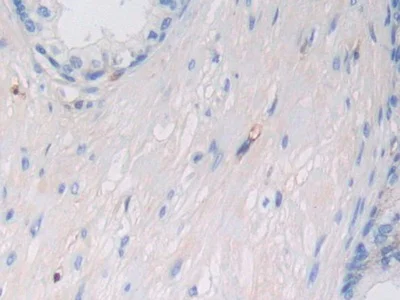 Immunohistochemistry (Formalin/PFA-fixed paraffin-embedded sections) - Anti-HLA-C antibody (AB232903)