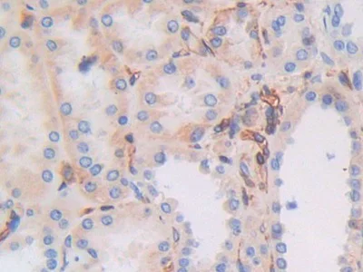 Immunohistochemistry (Formalin/PFA-fixed paraffin-embedded sections) - Anti-HLA-C antibody (AB232903)
