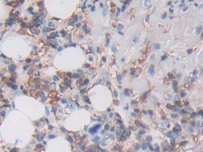 Immunohistochemistry (Formalin/PFA-fixed paraffin-embedded sections) - Anti-HLA-C antibody (AB232903)