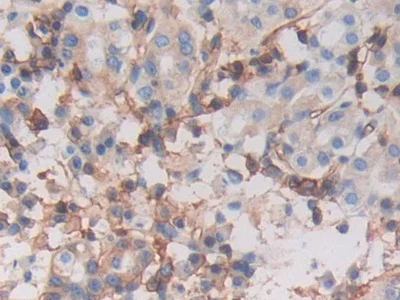 Immunohistochemistry (Formalin/PFA-fixed paraffin-embedded sections) - Anti-HLA-C antibody (AB232903)