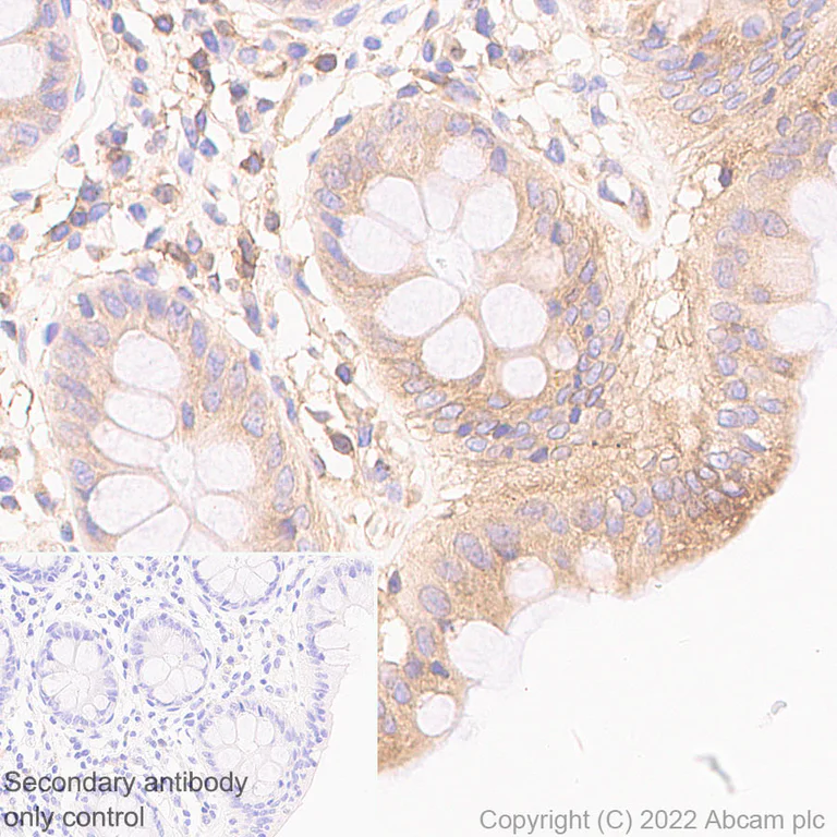 Immunohistochemistry (Formalin/PFA-fixed paraffin-embedded sections) - Anti-HLA-C antibody [EPR26121-73] - BSA and Azide free (AB307362)