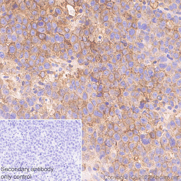 Immunohistochemistry (Formalin/PFA-fixed paraffin-embedded sections) - Anti-HLA-C antibody [EPR26121-73] - BSA and Azide free (AB307362)