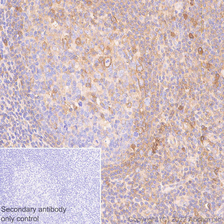 Immunohistochemistry (Formalin/PFA-fixed paraffin-embedded sections) - Anti-HLA-C antibody [EPR26121-73] - BSA and Azide free (AB307362)