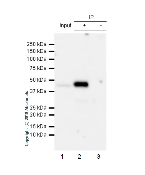 Immunoprecipitation - Anti-HLA-C antibody [EPR6749] (AB126722)