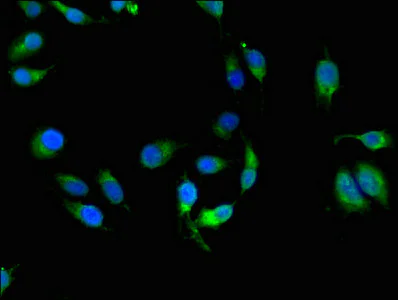 Immunocytochemistry/ Immunofluorescence - Anti-HLA-C antibody - Extracellular domain (AB193432)