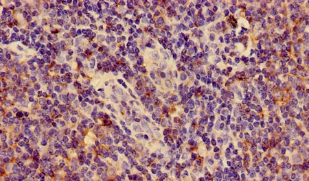 Immunohistochemistry (Formalin/PFA-fixed paraffin-embedded sections) - Anti-HLA-C antibody - Extracellular domain (AB193432)