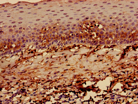 Immunohistochemistry (Formalin/PFA-fixed paraffin-embedded sections) - Anti-HLA-C antibody - Extracellular domain (AB193432)