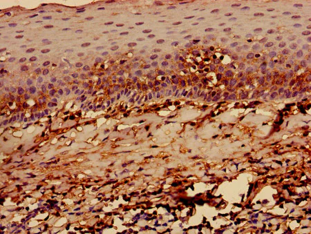 Immunohistochemistry (Formalin/PFA-fixed paraffin-embedded sections) - Anti-HLA-C antibody - Extracellular domain (AB193432)