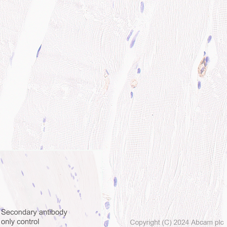 Immunohistochemistry (Formalin/PFA-fixed paraffin-embedded sections) - Anti-HLA Class 1 ABC antibody [EMR8-5] (AB70328), expandable thumbnail