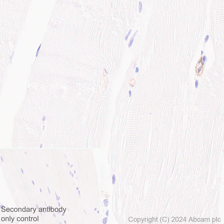 Immunohistochemistry (Formalin/PFA-fixed paraffin-embedded sections) - Anti-HLA Class 1 ABC antibody [EMR8-5] (AB70328)