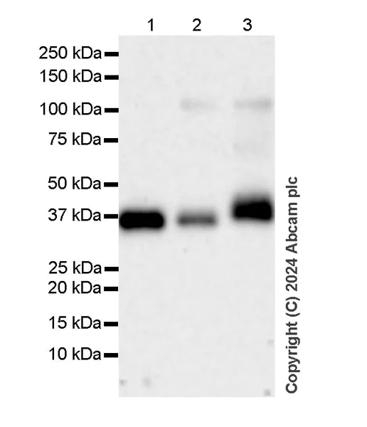Western blot - Anti-HLA Class 1 ABC antibody [EMR8-5] (AB70328)