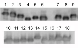 Western blot - Anti-HLA Class 1 ABC antibody [EMR8-5] (AB70328), expandable thumbnail
