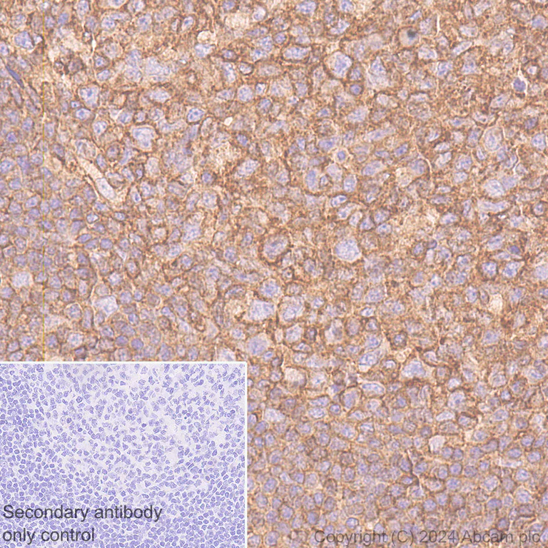 Immunohistochemistry (Formalin/PFA-fixed paraffin-embedded sections) - Anti-HLA Class 1 ABC antibody [EMR8-5] - BSA and Azide free (AB318990)