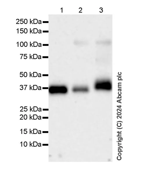 Western blot - Anti-HLA Class 1 ABC antibody [EMR8-5] - BSA and Azide free (AB318990)