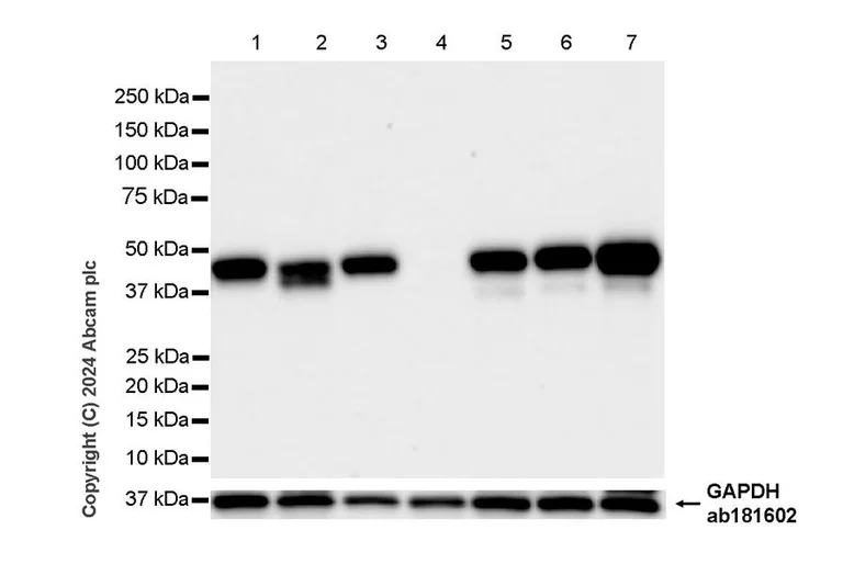 Western blot - Anti-HLA Class 1 ABC antibody [EMR8-5] - BSA and Azide free (AB318990)