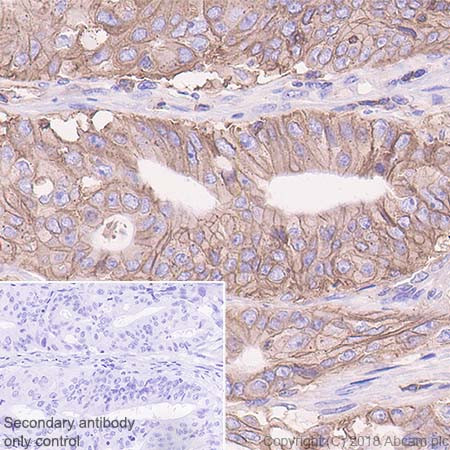 Immunohistochemistry (Formalin/PFA-fixed paraffin-embedded sections) - Anti-HLA Class 1 ABC antibody [EPR22172] - BSA and Azide free (ab239788), expandable thumbnail